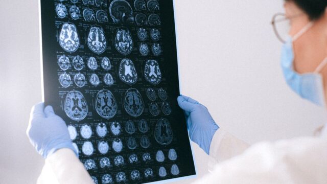 brain research — Fishy business: Can a tiny fish unlock the secrets of the human brain? (featured)