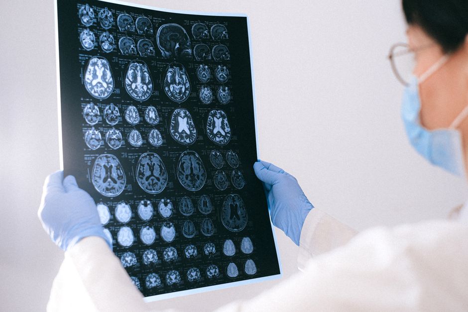 brain research — Fishy business: Can a tiny fish unlock the secrets of the human brain? (featured)