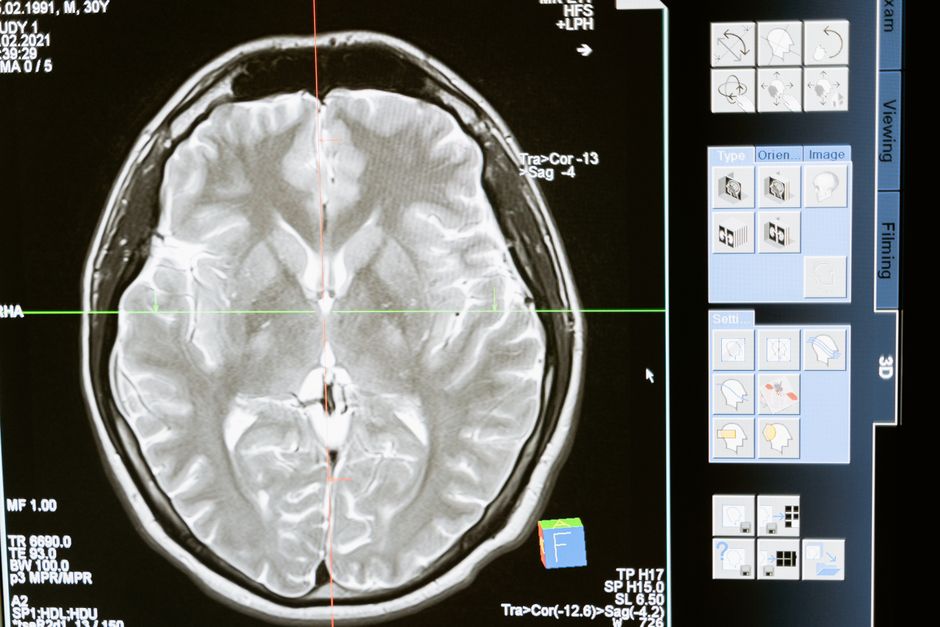 brain science — Brain Science's Next Big Catch: Is it a Fish? (photo)