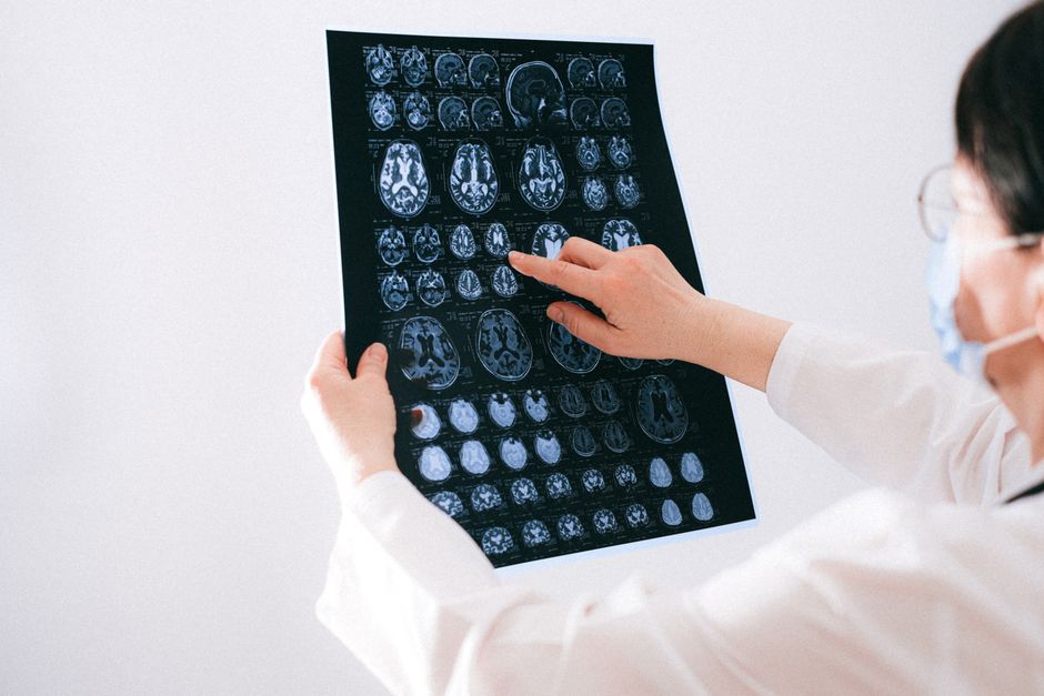 artificial intelligence in neurology — Will AI Revolutionize Neurology or Overstep Boundaries? (photo)